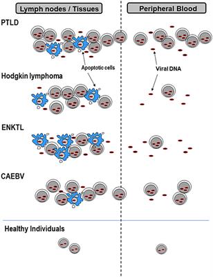 EBV Viral Loads in Diagnosis, Monitoring, and Response Assessment